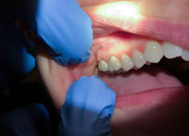 Best Cosmetic Emergency Dentistry in Hopkins, MN